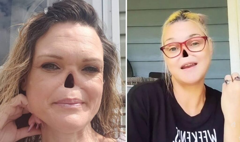 EstA mulher teve o seu nariz removido por causa de uma simpl… Ver MaiS!!