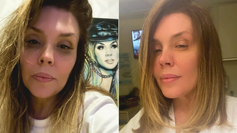 Chega A0 fim a luta de Simony contra o câncer!!…Veja Mais