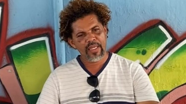 FOI CONFIRMADO: Após se envolver em briga, Givaldo Alves o mendigo acabou send…Ver mais