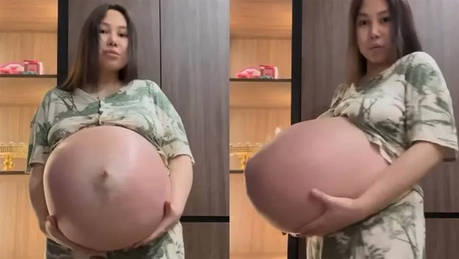 Mulher vai ao médico suspeitando de uma gravidez normal, e deixa todos assustados ao descobrir o que tinha em sua barri… Ver mais