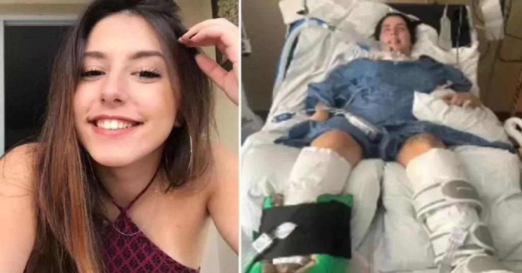 “Foi apenas uma colher!”: Jovem de 23 anos fica tetraplégica ao tomar um pouco de… Ver mais