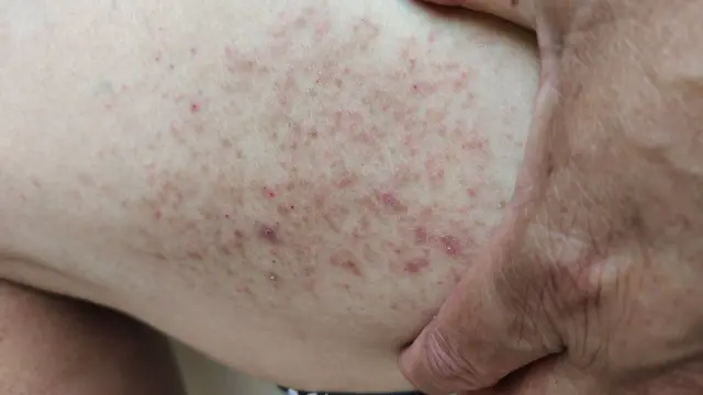 Você tem estes sinais na pele? Isso diz algo importante sobre sua… Ver mais