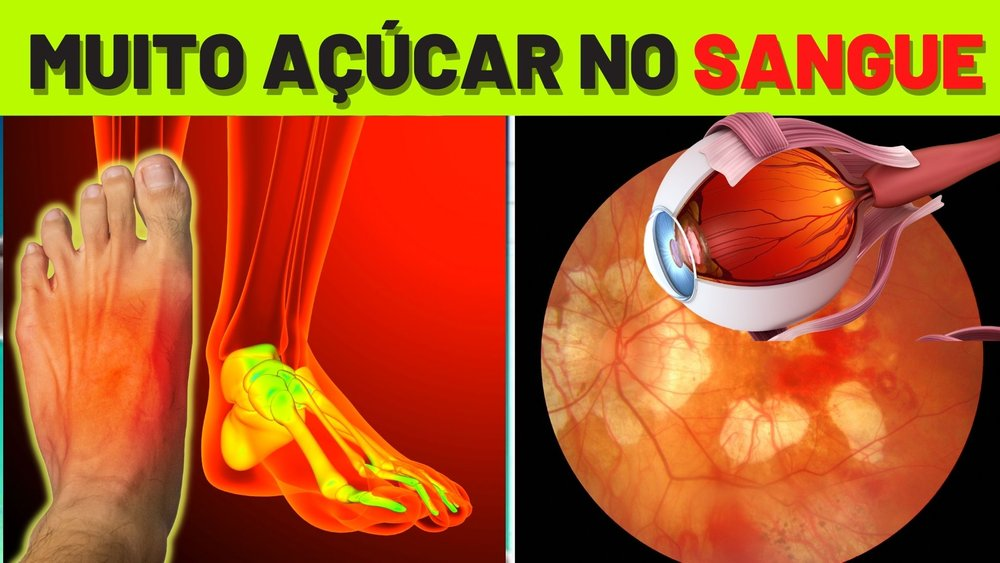 Após diabetes José Loreto foi …Ver Mais